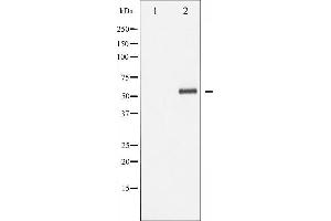 Western blot analysis of p62 Dok phosphorylation expression in Jurkat whole cell lysates,The lane on the left is treated with the antigen-specific peptide. (DOK1 antibody  (pTyr362))