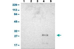 Western Blot analysis of (1) human cell line RT-4 (2) human cell line U-251MG sp (3) human plasma (IgG/HSA depleted) (4) human liver tissue, and (5) human tonsil tissue.