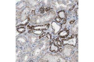 Immunohistochemical staining of human kidney with CLMN polyclonal antibody  shows strong membranous positivity in cells in tubules. (CLMN antibody)