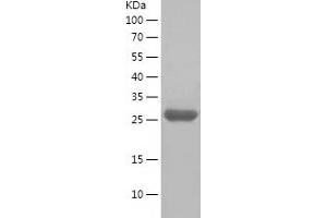 Western Blotting (WB) image for Receptor Tyrosine-Protein Kinase ErbB-3 (ERBB3) (AA 1005-1230) protein (His tag) (ABIN7124803) (ERBB3 Protein (AA 1005-1230) (His tag))