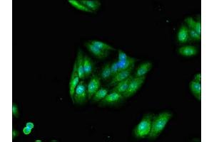 Immunofluorescent analysis of HepG2 cells using ABIN7173463 at dilution of 1:100 and Alexa Fluor 488-congugated AffiniPure Goat Anti-Rabbit IgG(H+L) (TRIM54 antibody  (AA 60-358))