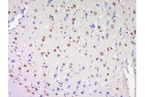Formalin-fixed and paraffin embedded rat brain labeled with Anti-ProSAPiP1 Polyclonal Antibody, Unconjugated  at 1:200 followed by conjugation to the secondary antibody and DAB staining