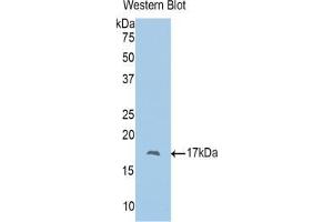 Western blot analysis of the recombinant protein. (Polybromo 1 antibody  (AA 957-1086))
