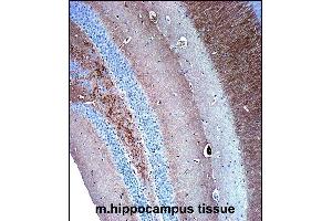 Immunohistochemistry (Paraffin-embedded Sections) (IHC (p)) image for anti-Synaptophysin (SYP) (AA 225-253), (C-Term) antibody (ABIN1881862)