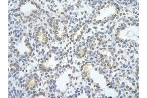 Rabbit Anti-EXOSC2 antibody   Paraffin Embedded Tissue: Human Lung cell Cellular Data: alveolar cell of renal tubule Antibody Concentration: 4. (EXOSC2 antibody  (N-Term))
