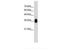 Image no. 1 for anti-Makorin Ring Finger Protein 1 (MKRN1) (AA 371-420) antibody (ABIN203525) (MKRN1 antibody  (AA 371-420))