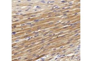 Immunohistochemistry analysis of paraffin-embedded rat carditis using,CTNT (ABIN7076033) at dilution of 1: 400 (Cardiac Troponin T2 antibody)
