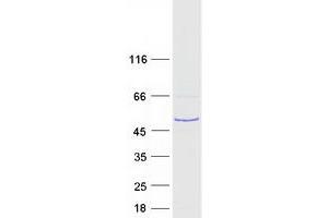 Western Blotting (WB) image for Radial Spoke Head 1 Homolog (RSPH1) protein (Myc-DYKDDDDK Tag) (ABIN2731219)
