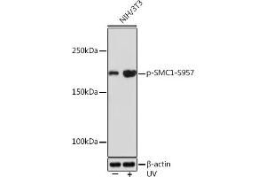 Western blot analysis of extracts of NIH/3T3 cells, using Phospho-SMC1-S957 Rabbit mAb (ABIN7270613) at 1:1000 dilution. (SMC1A antibody  (pSer957))