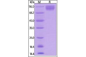 SDS-PAGE (SDS) image for Signal-Regulatory Protein alpha (SIRPA) (AA 32-373) (Active) protein (Fc Tag) (ABIN6253632)