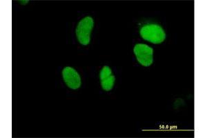 Immunofluorescence of purified MaxPab antibody to GTF3C5 on HeLa cell. (GTF3C5 antibody  (AA 1-519))