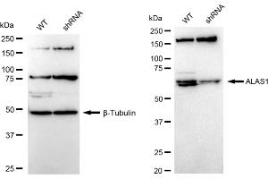 Western blotting analysis using ALAS1 antibody (ABIN7797590). (Recombinant ALAS1 antibody)