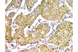 IHC analysis of GM130 using anti-GM130 antibody (ABIN6719433). (Golgin A2 (GOLGA2) (AA 796-913) antibody)