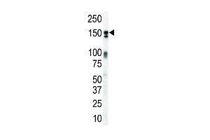 Western blot analysis of anti-ErbB3 Pab (ABIN391949 and ABIN2841747) in mouse brain lysate.