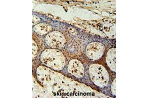anti-Zinc Finger CCCH-Type Containing 3 (ZC3H3) (AA 918-948), (C-Term) antibody