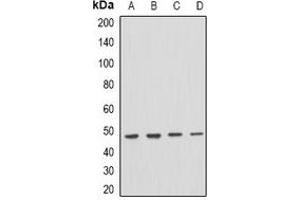 Western blot analysis of PSTPIP1 expression in THP1 (A), mouse spleen (B), mouse brain (C), rat brain (D) whole cell lysates. (PSTPIP1 antibody)