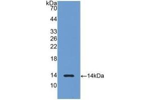 Detection of Recombinant LHb, Rat using Polyclonal Antibody to Luteinizing Hormone Beta Polypeptide (LHb) (LHB antibody  (AA 21-141))