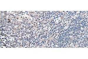 Immunohistochemistry of paraffin-embedded Human tonsil tissue using ZBTB10 Polyclonal Antibody at dilution of 1:100(x200) (ZBTB10 antibody)