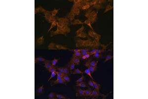 Immunofluorescence analysis of C6 cells using EIF2B2 antibody (ABIN6132131, ABIN6140037, ABIN6140038 and ABIN6222805) at dilution of 1:100. (EIF2B2 antibody  (AA 1-351))