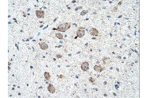 Image no. 1 for anti-Kelch-Like 25 (KLHL25) (AA 163-212) antibody (ABIN203314) (KLHL25 antibody  (AA 163-212))