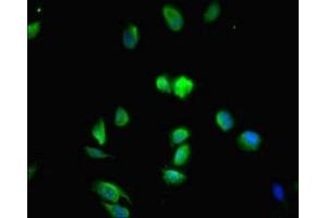 Immunofluorescent analysis of Hela cells using ABIN7159120 at dilution of 1:100 and Alexa Fluor 488-congugated AffiniPure Goat Anti-Rabbit IgG(H+L)