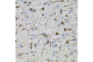 Immunohistochemistry of paraffin-embedded rat brain using TRP antibody (ABIN6133559, ABIN6149565, ABIN6149567 and ABIN6224668) at dilution of 1:100 (40x lens). (TRPA1 antibody  (AA 850-950))