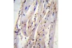 Formalin fixed and paraffin embedded m. (Syntaxin 19 antibody  (C-Term))