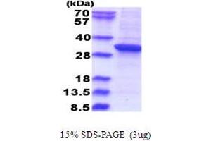 SDS-PAGE (SDS) image for Ras Suppressor Protein 1 (RSU1) (AA 1-277) protein (His tag) (ABIN5853680) (RSU1 Protein (AA 1-277) (His tag))