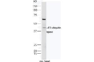 Mouse heart lysates probed with Rabbit Anti-E3 ubiquitin ligase Polyclonal Antibody, Unconjugated  at 1:5000 for 90 min at 37˚C.
