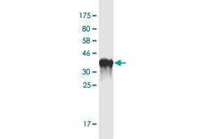 Western Blot detection against Immunogen (35. (Otopetrin 1 antibody  (AA 415-504))