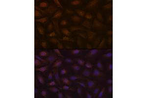 Immunofluorescence analysis of U-2 OS cells using KIF Rabbit mAb (ABIN7268120) at dilution of 1:100 (40x lens). (KIFAP3 antibody)