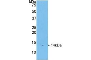 Detection of Recombinant FAM19A2, Mouse using Polyclonal Antibody to Family With Sequence Similarity 19, Member A2 (FAM19A2) (FAM19A2 antibody  (AA 31-119))