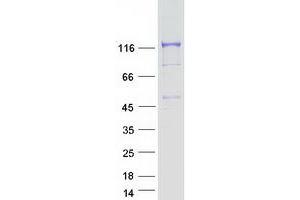 Validation with Western Blot (CYFIP2 Protein (Transcript Variant 3) (Myc-DYKDDDDK Tag))
