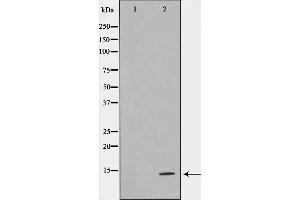 Western blot analysis on HeLa cell lysate using TUSC2 Antibody,The lane on the left is treated with the antigen-specific peptide. (TUSC2 antibody  (Internal Region))