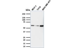 Western Blotting (WB) image for anti-Tumor Protein P63 (TP63) (AA 3-106) antibody (ABIN6940965)