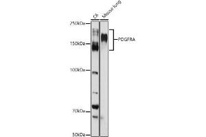 Western blot analysis of extracts of various cell lines, using PDGFRA antibody (ABIN3022920, ABIN3022921, ABIN3022922 and ABIN6219298) at 1:1000 dilution. (PDGFRA antibody  (AA 1-210))