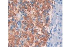 #VALUE! (CTBP2 antibody  (AA 1-252))