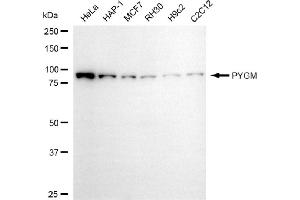 anti-Phosphorylase, Glycogen, Muscle (PYGM) antibody