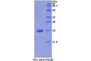 SDS-PAGE (SDS) image for Galactosylceramidase (GALC) (AA 375-535) protein (His tag) (ABIN1099092)
