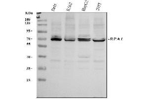 Western blot analysis of RPA70 using anti-RPA70 antibody (ABIN3044541). (RPA1 antibody  (C-Term))