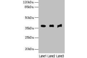 Western blot All lanes: MRNIP antibody at 4 μg/mL Lane 1: Mouse kidney tissue Lane 2: Mouse heart tissue Lane 3: Hela whole cell lysate Secondary Goat polyclonal to rabbit IgG at 1/10000 dilution Predicted band size: 38, 30, 32 kDa Observed band size: 38 kDa (MRN Complex-Interacting Protein (MRNIP) (AA 1-200) antibody)