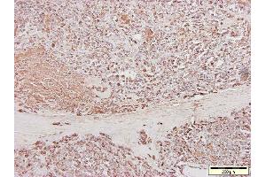 Image no. 1 for anti-Cardiotin antibody (ABIN335361) (Cardiotin antibody)