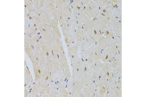 Immunohistochemistry (Paraffin-embedded Sections) (IHC (p)) image for anti-Small Nuclear Ribonucleoprotein Polypeptide A (SNRPA) (AA 1-282) antibody (ABIN6148210)