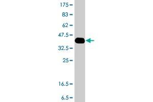 Western Blot detection against Immunogen (37. (CACNA1C antibody  (AA 2039-2138))