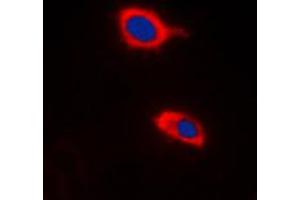 Immunofluorescent analysis of HCCS staining in Raw264. (HCCS antibody  (Center))