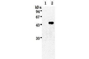 Western Blotting (WB) image for anti-Sialidase 3 (Membrane Sialidase) (Neu3) antibody (ABIN1449196) (Neu3 antibody)