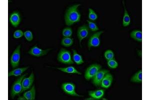 Immunofluorescent analysis of A549 cells using ABIN7146265 at dilution of 1:100 and Alexa Fluor 488-congugated AffiniPure Goat Anti-Rabbit IgG(H+L) (Tescalcin antibody  (AA 2-214))