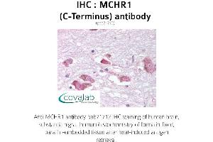 Image no. 1 for anti-Melanin-Concentrating Hormone Receptor 1 (MCHR1) (C-Term) antibody (ABIN1736817) (MCHR1 antibody  (C-Term))