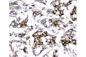 IHC analysis of AEBP2 using anti-AEBP2 antibody (ABIN4886435). (AEBP2 antibody  (AA 424-517))