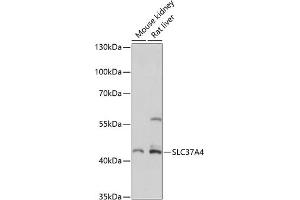 Western blot analysis of extracts of various cell lines, using SLC37 antibody (ABIN7270453) at 1:3000 dilution.